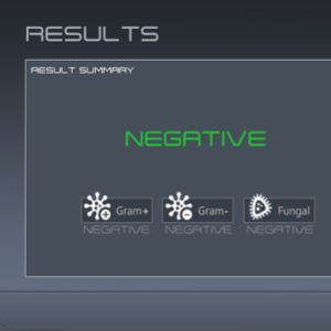  YES/NO detection 